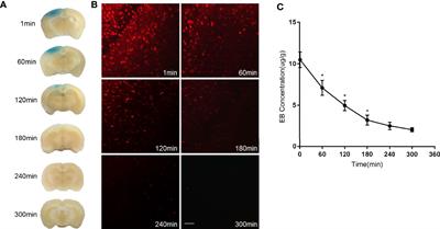 Low Frequency Ultrasound With Injection of NMO-IgG and Complement Produces Lesions Different From Experimental Autoimmune Encephalomyelitis Mice